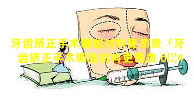 牙齿矫正手术哪些材料更昂贵「牙齿矫正手术哪些材料更昂贵 🦢 一点」